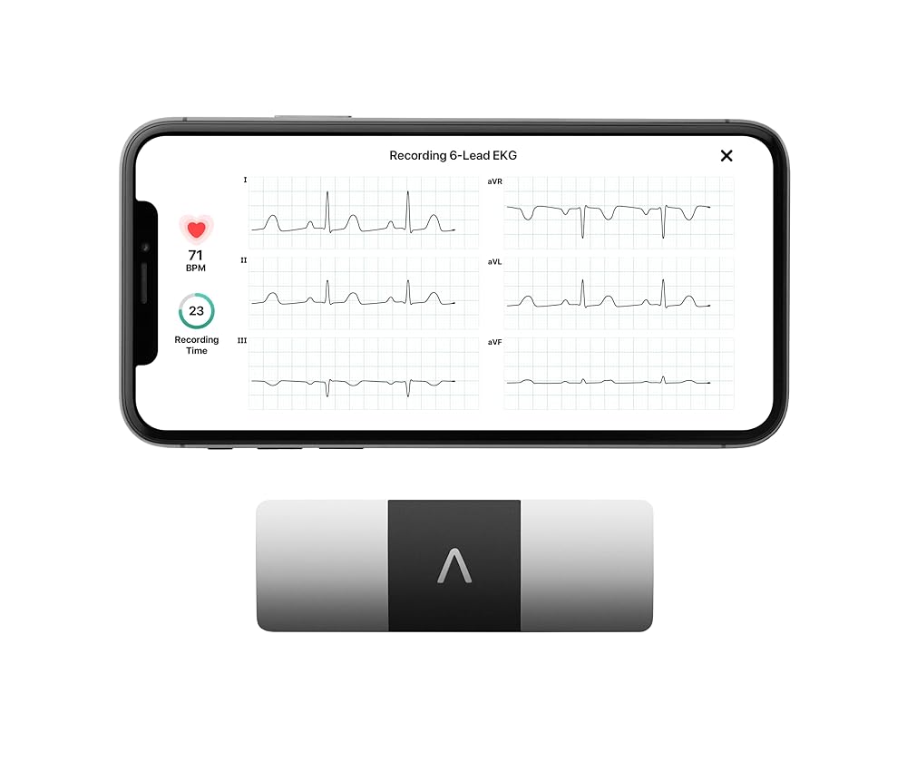 KardiaMobile 6-Lead Personal EKG Monitor – Six Views of The Heart – Detects AFib and Irregular Arrhythmias – Instant Results in 30 Seconds – Works with Most Smartphones -... KardiaMobile 6-Lead Personal EKG Monitor – Six Views of The Heart – Detects AFib and Irregular Arrhythmias – Instant Results in 30 Seconds – Works with Most Smartphones -...